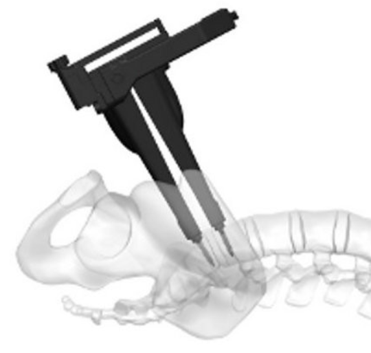 Advances in spinal surgery