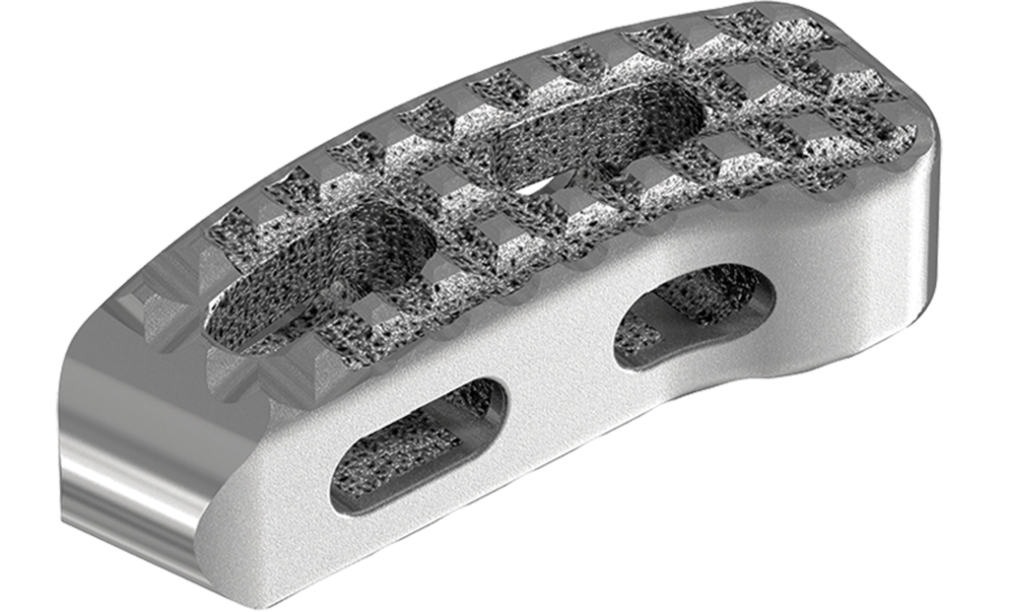 Metal Additive Manufactured Spinal Fusion Cage
